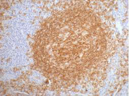 MS4A1 Monoclonal Antibody