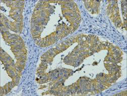 KRT8 Monoclonal Antibody