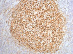 CR2 Monoclonal Antibody