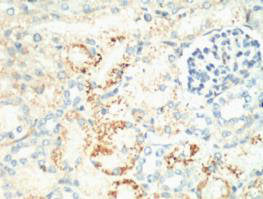 MKI67 Monoclonal Antibody