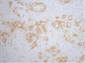 CTNNB1 Monoclonal Antibody