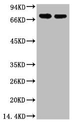 AFP Monoclonal Antibody