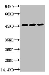 KRT18 Monoclonal Antibody