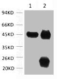 ACTA1 Monoclonal Antibody