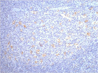CD68 Monoclonal Antibody