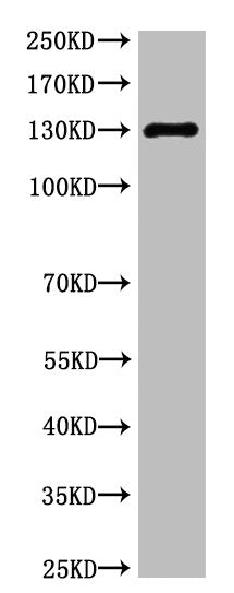 NOS3 Monoclonal Antibody
