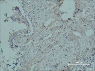 PGR Monoclonal Antibody