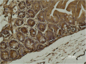 ACTA2 Monoclonal Antibody