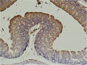 ACTA2 Monoclonal Antibody