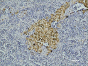 CASP8 Monoclonal Antibody