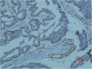BIRC5 Monoclonal Antibody
