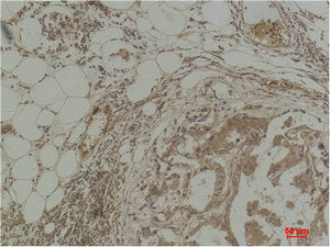 Pan Methylated Lysine Monoclonal Antibody