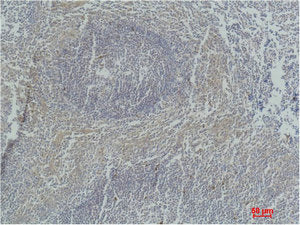CASP3 Monoclonal Antibody