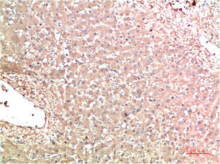 TTR Monoclonal Antibody