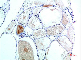 TTR Monoclonal Antibody