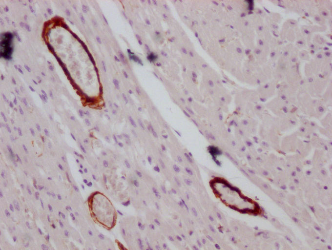 ACTA2/ACTG2 Monoclonal Antibody