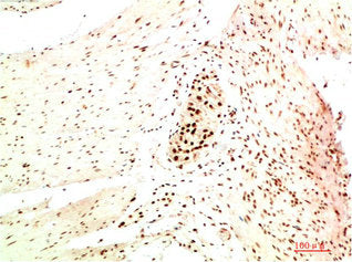 CBX5 Monoclonal Antibody