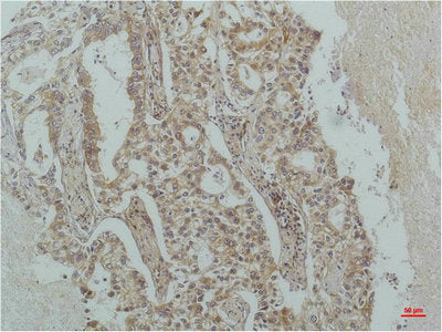 NFKBIB Monoclonal Antibody