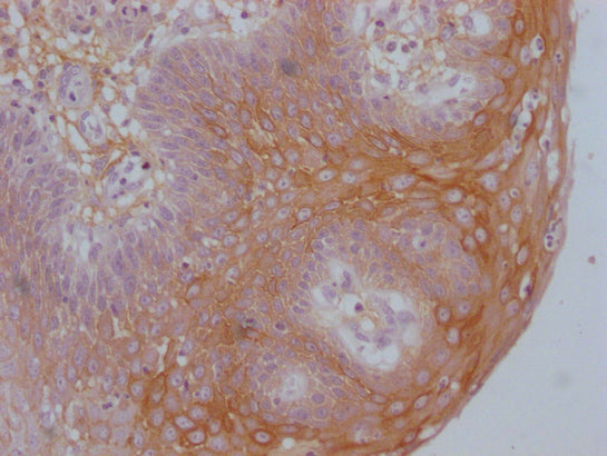 KRT16 Monoclonal Antibody