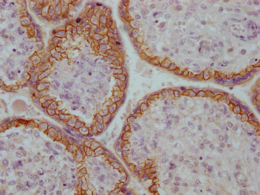 CDH1 Monoclonal Antibody