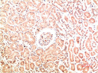 COL4A1 Monoclonal Antibody