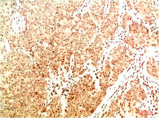 Acetyl-RELA(K314/K315) Monoclonal Antibody