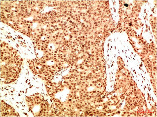 Acetyl-RELA(K314/K315) Monoclonal Antibody