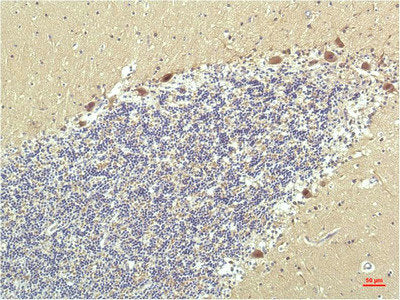 PPARD Monoclonal Antibody