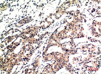 Ubiquitin Monoclonal Antibody