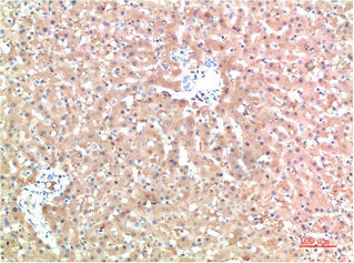 TTR Monoclonal Antibody