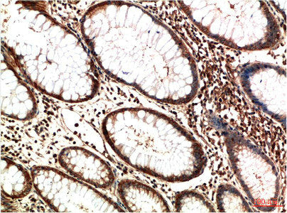 ATM Monoclonal Antibody