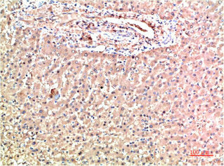 TTR Monoclonal Antibody