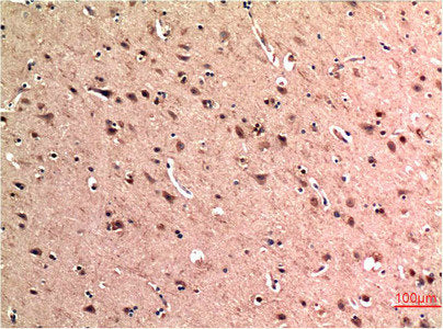 BECN1 Monoclonal Antibody