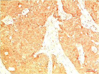Acetyl-TP53(K382) Monoclonal Antibody