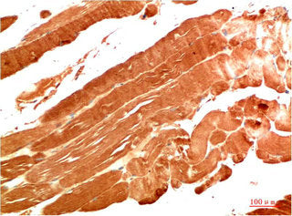 NBR1 Monoclonal Antibody