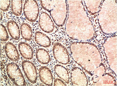 ATM Monoclonal Antibody