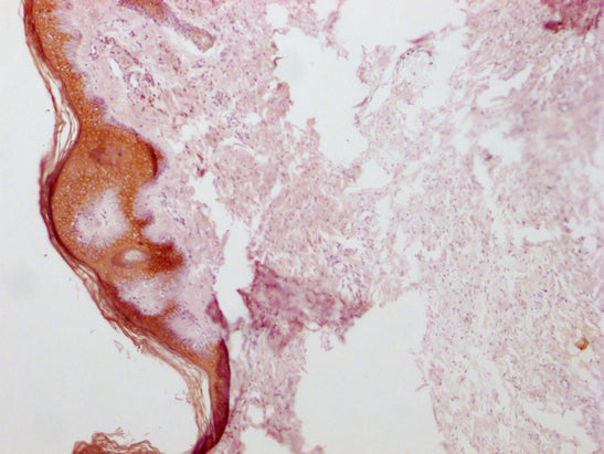 KRT1 Monoclonal Antibody