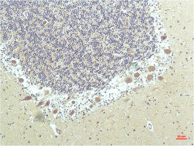 PPARD Monoclonal Antibody