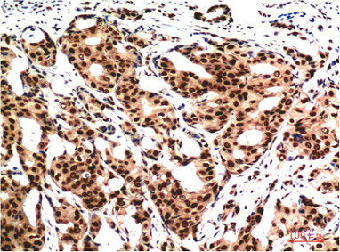 Ubiquitin Monoclonal Antibody