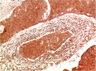 JAK2 Monoclonal Antibody