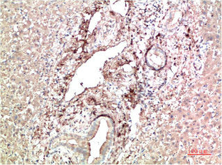 TTR Monoclonal Antibody