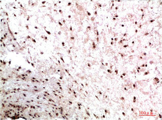 CBX3 Monoclonal Antibody