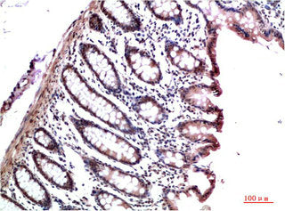 CBX3 Monoclonal Antibody