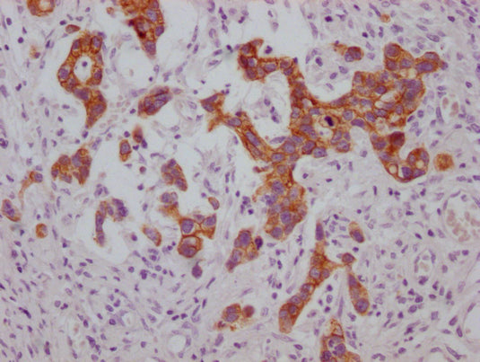KRT19 Monoclonal Antibody