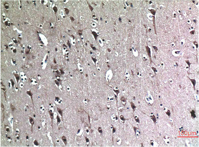 BECN1 Monoclonal Antibody