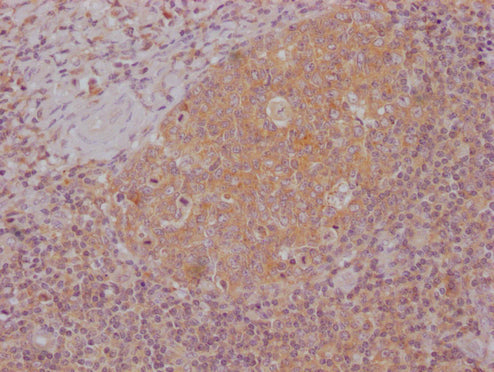 MS4A1 Monoclonal Antibody