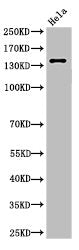 Cleaved-SPTAN1 (D1185) Antibody