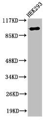 ZC3H7B Antibody