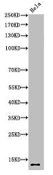 Acetyl-Histone H4 (K5) Antibody
