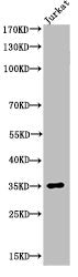 Acetyl-APEX1 (K7) Antibody